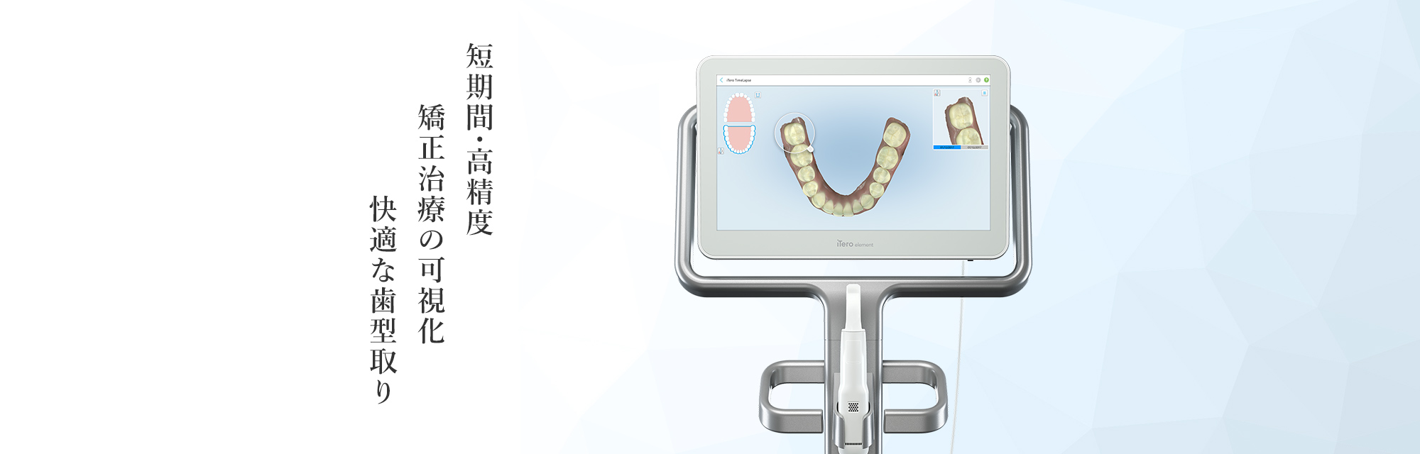 短期間・高精度 矯正治療の可視化 快適な歯型取り