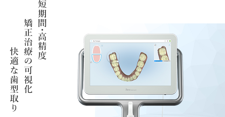 短期間・高精度 矯正治療の可視化 快適な歯型取り