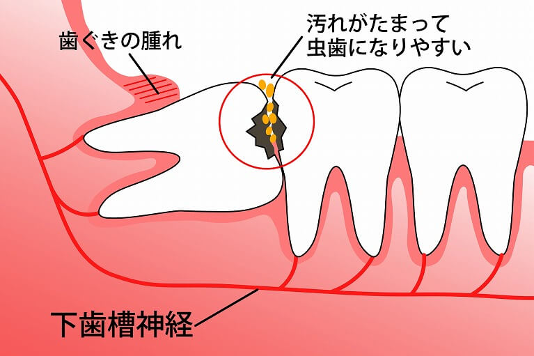 少しだけ見える程度に生えてきているが、これ以上生えてくる見込みがない